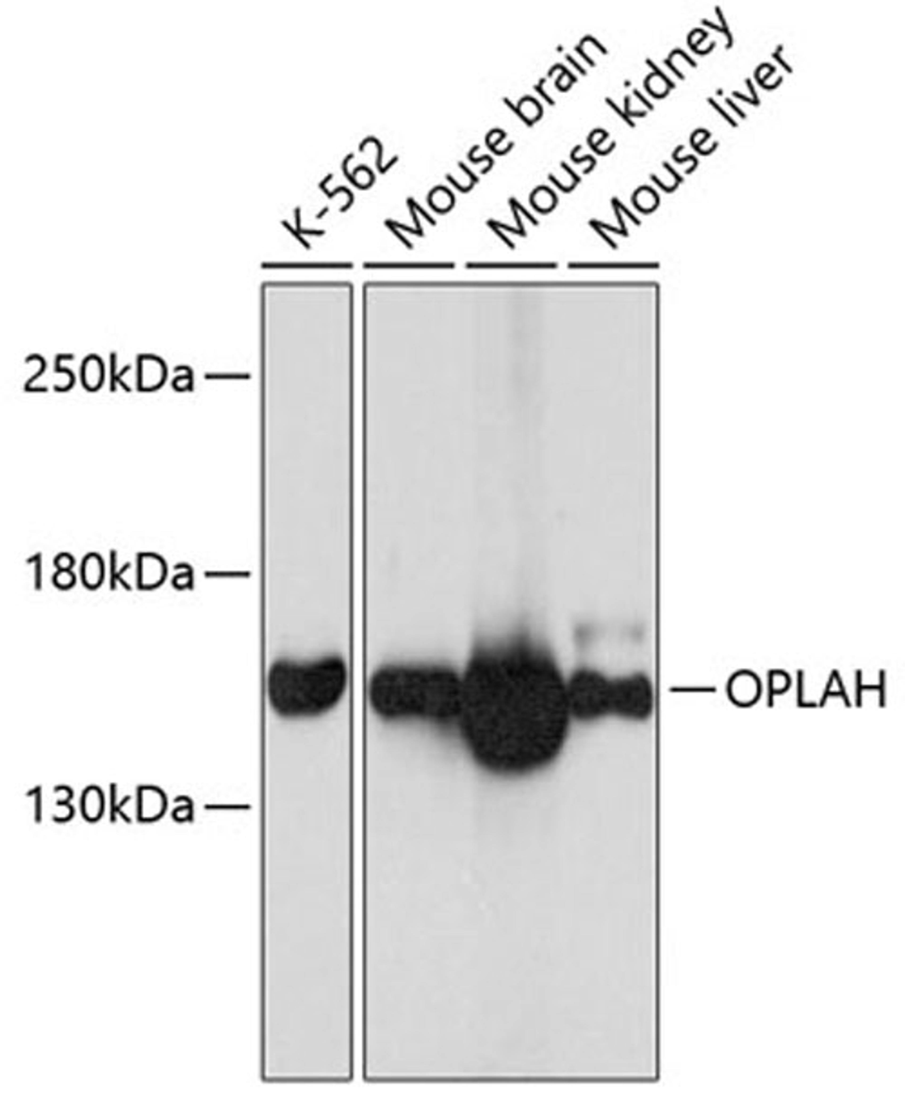 Western blot - OPLAH antibody (A12032)