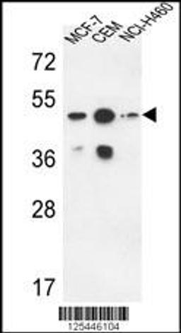 Western blot analysis in MCF-7,CEM,NCI-H460 cell line lysates (35ug/lane).