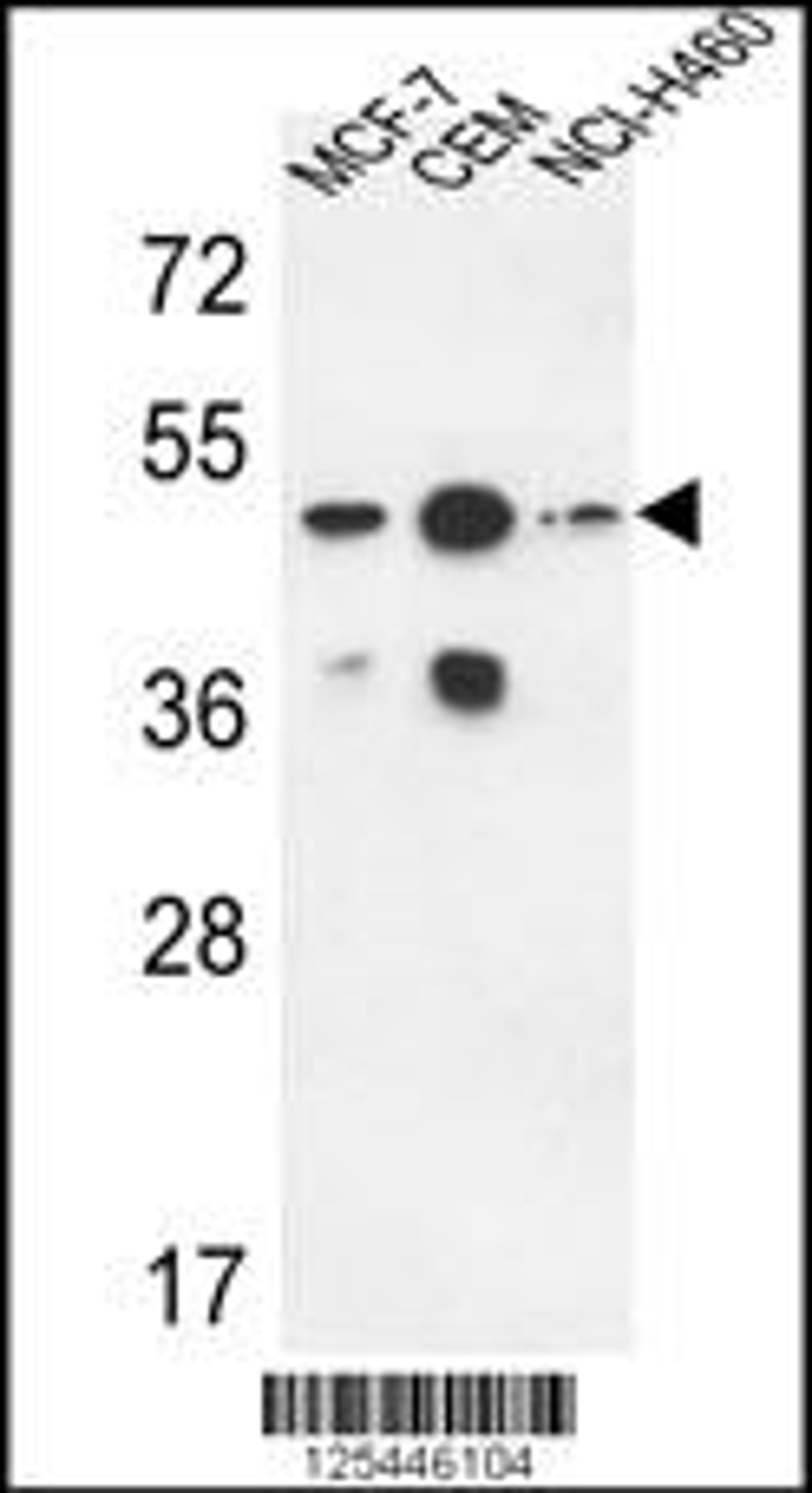 Western blot analysis in MCF-7,CEM,NCI-H460 cell line lysates (35ug/lane).