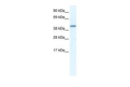 Antibody used in WB on Human Placenta at 2.5 ug/ml.