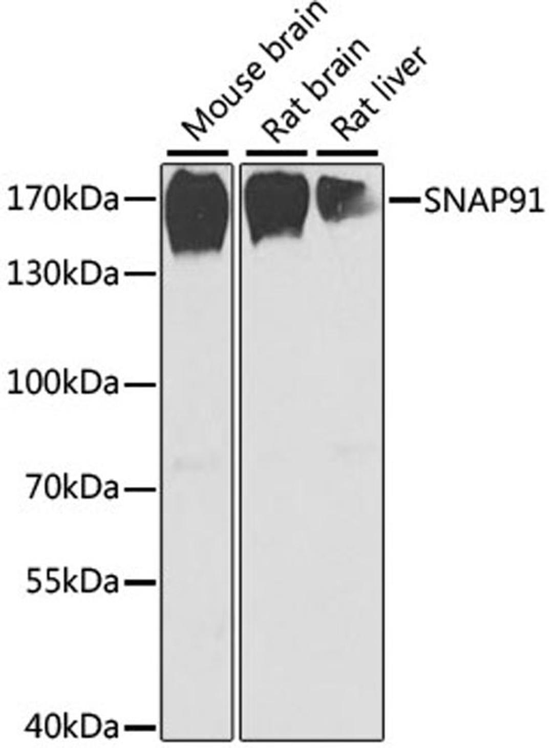 Western blot - SNAP91 antibody (A6746)