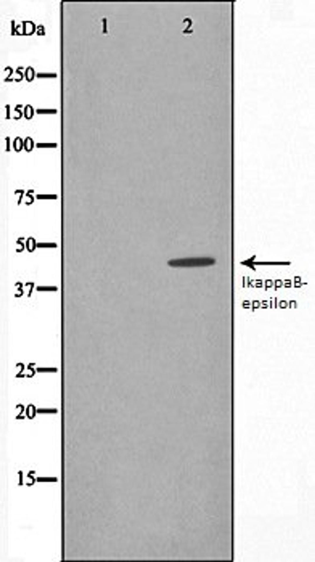 Western blot analysis of HeLa whole cell lysates using IkappaB-epsilon antibody, The lane on the left is treated with the antigen-specific peptide.