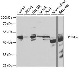 Western blot - PHKG2 antibody (A7337)