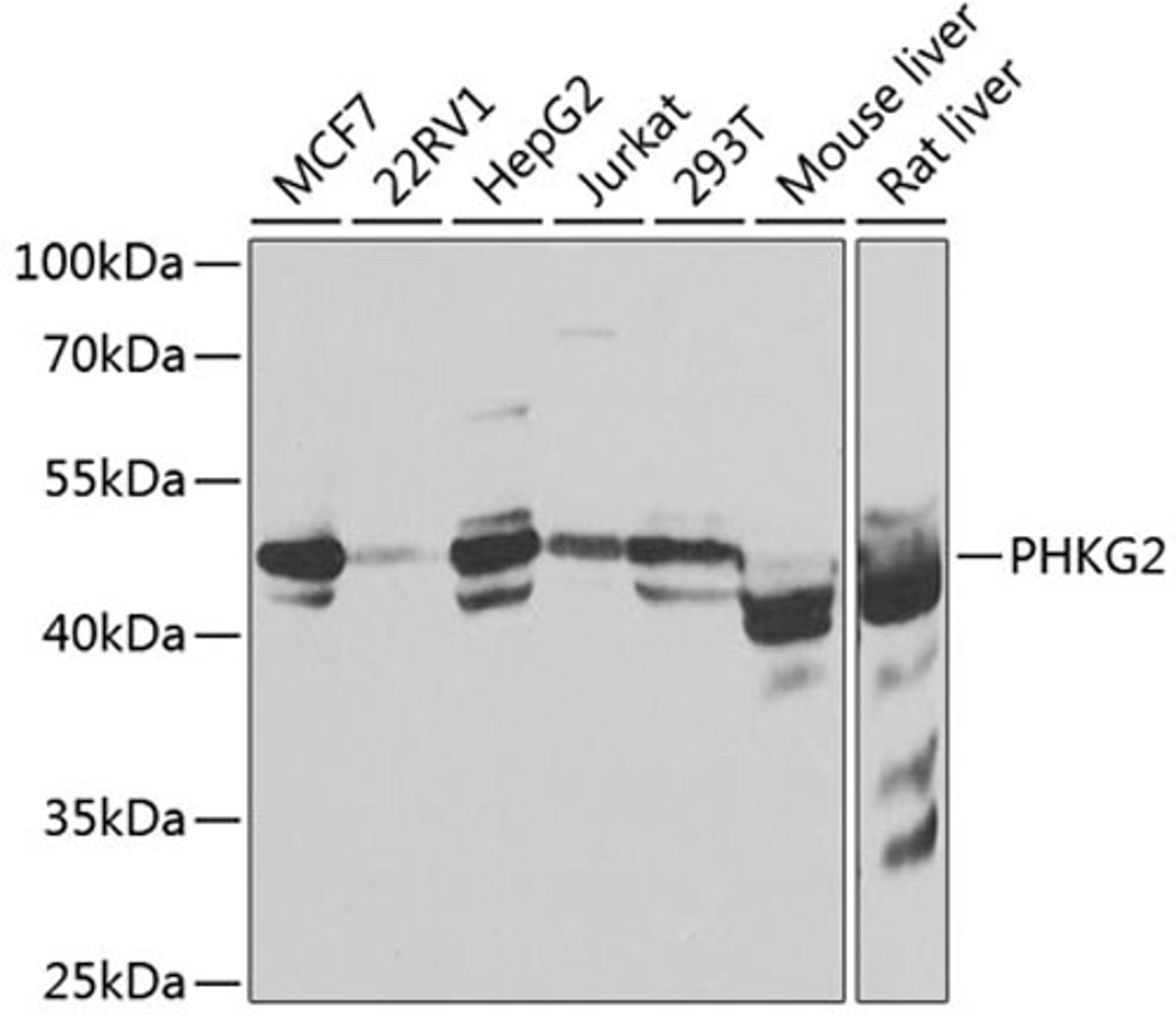 Western blot - PHKG2 antibody (A7337)