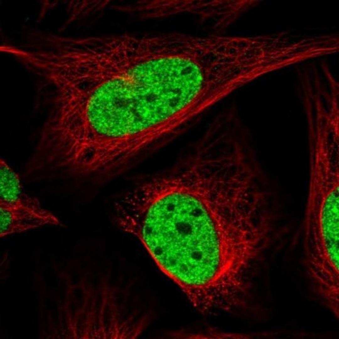 Immunocytochemistry/Immunofluorescence: SUHW1 Antibody [NBP1-92459] - Staining of human cell line U-2 OS shows positivity in nucleus but not nucleoli.