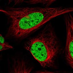 Immunocytochemistry/Immunofluorescence: SUHW1 Antibody [NBP1-92459] - Staining of human cell line U-2 OS shows positivity in nucleus but not nucleoli.