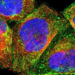 Immunocytochemistry/Immunofluorescence: Desmoglein 2 Antibody [NBP1-85709] Staining of human cell line A-431 shows positivity in plasma membrane.