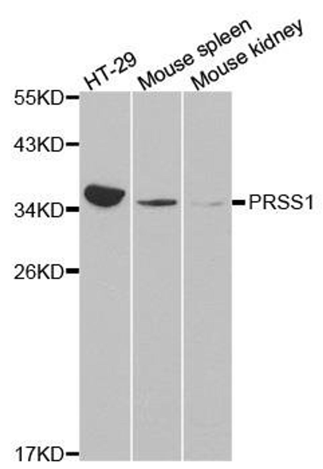 Western blot analysis of extracts of various cell lines using PRSS1 antibody