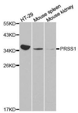 Western blot analysis of extracts of various cell lines using PRSS1 antibody