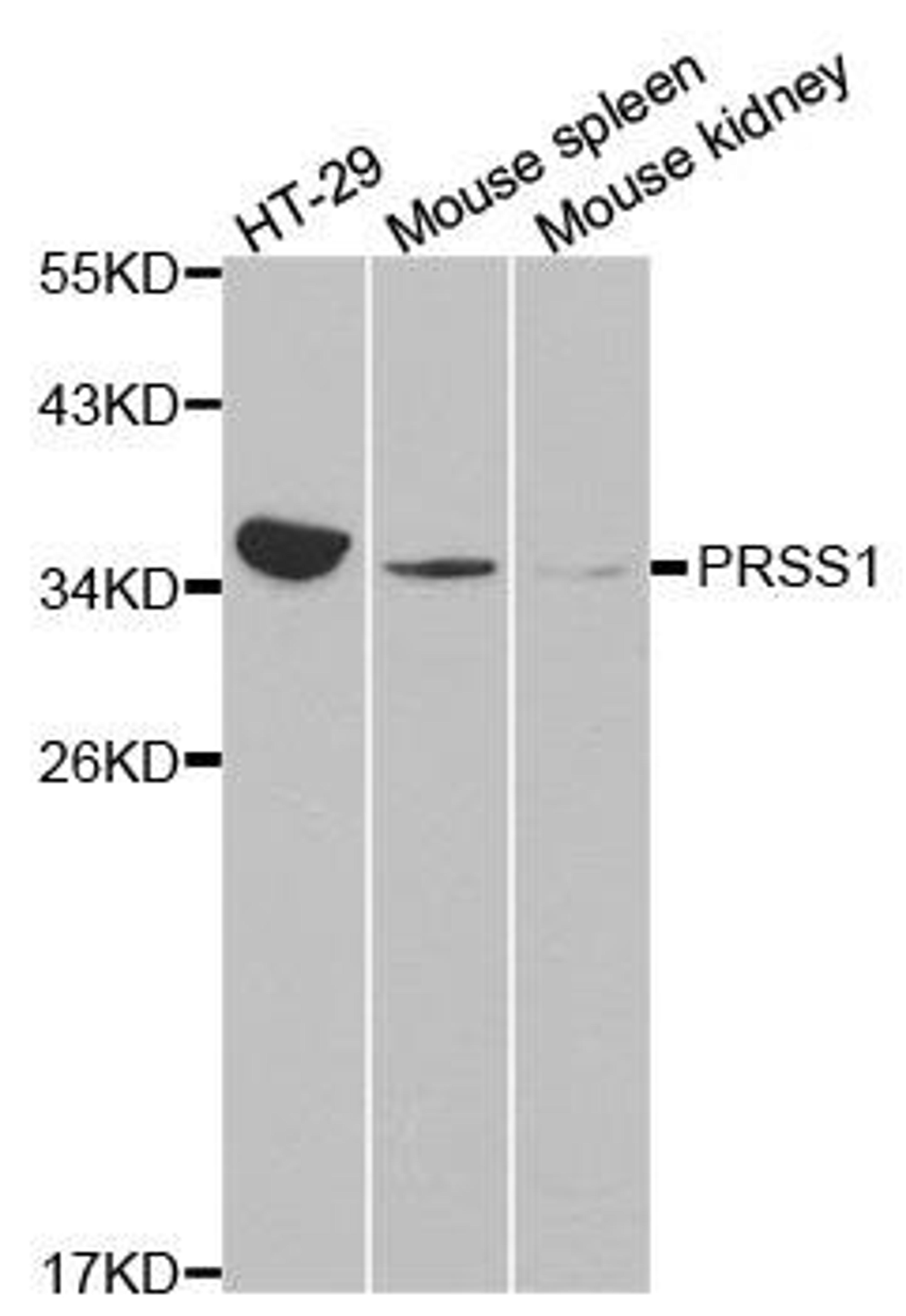 Western blot analysis of extracts of various cell lines using PRSS1 antibody