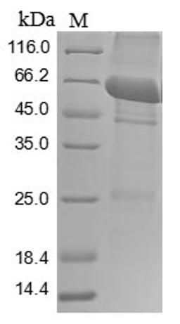 (Tris-Glycine gel) Discontinuous SDS-PAGE (reduced) with 5% enrichment gel and 15% separation gel.