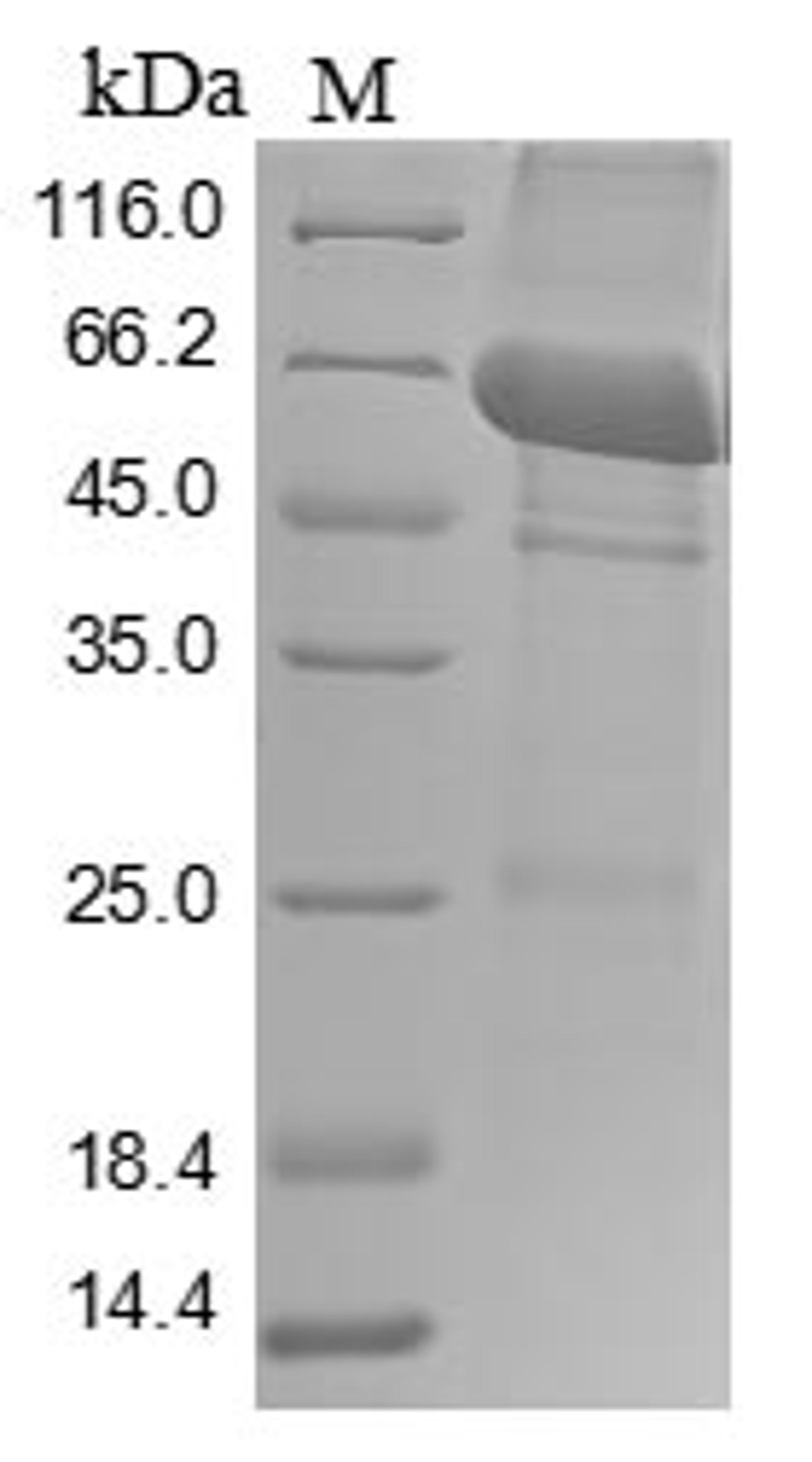 (Tris-Glycine gel) Discontinuous SDS-PAGE (reduced) with 5% enrichment gel and 15% separation gel.
