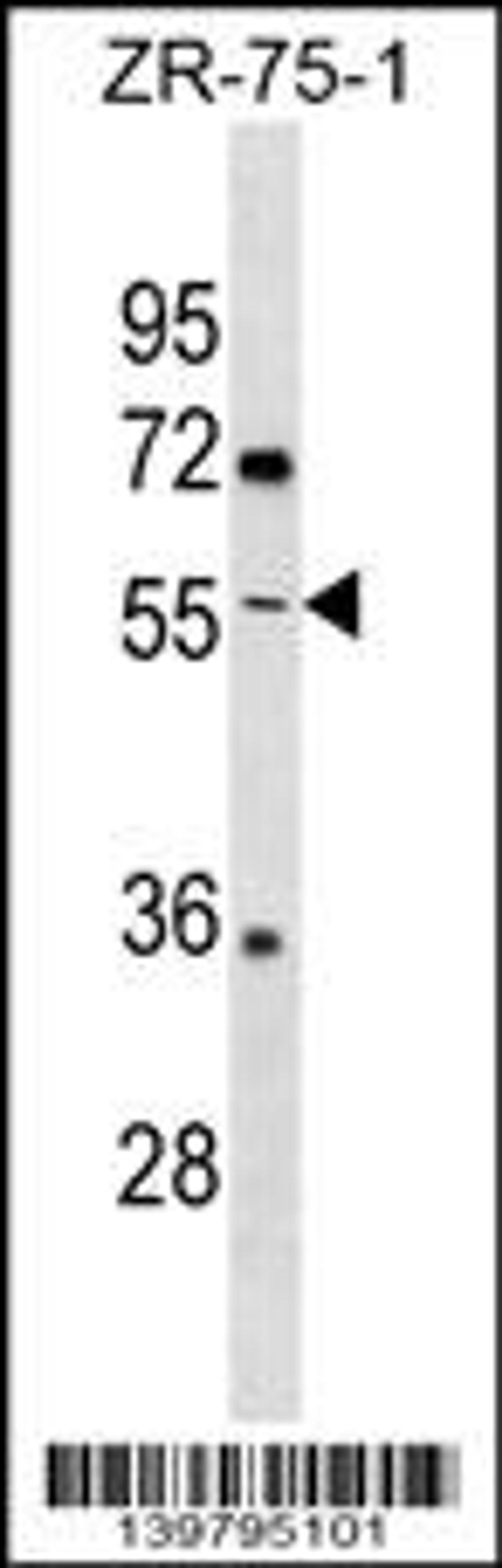 Western blot analysis in ZR-75-1 cell line lysates (35ug/lane).