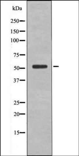 Western blot analysis of heatshockK562 whole cell lysates using BRK -Phospho-Tyr342- antibody