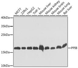 Western blot - PPIB antibody (A7713)