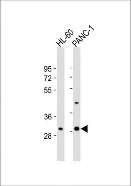 Western Blot at 1:1000 dilution Lane 1: HL-60 whole cell lysate Lane 2: PANC-1 whole cell lysate Lysates/proteins at 20 ug per lane.