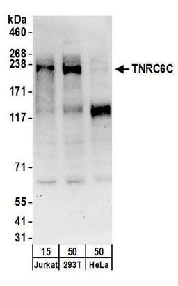 Detection of human TNRC6C by WB.