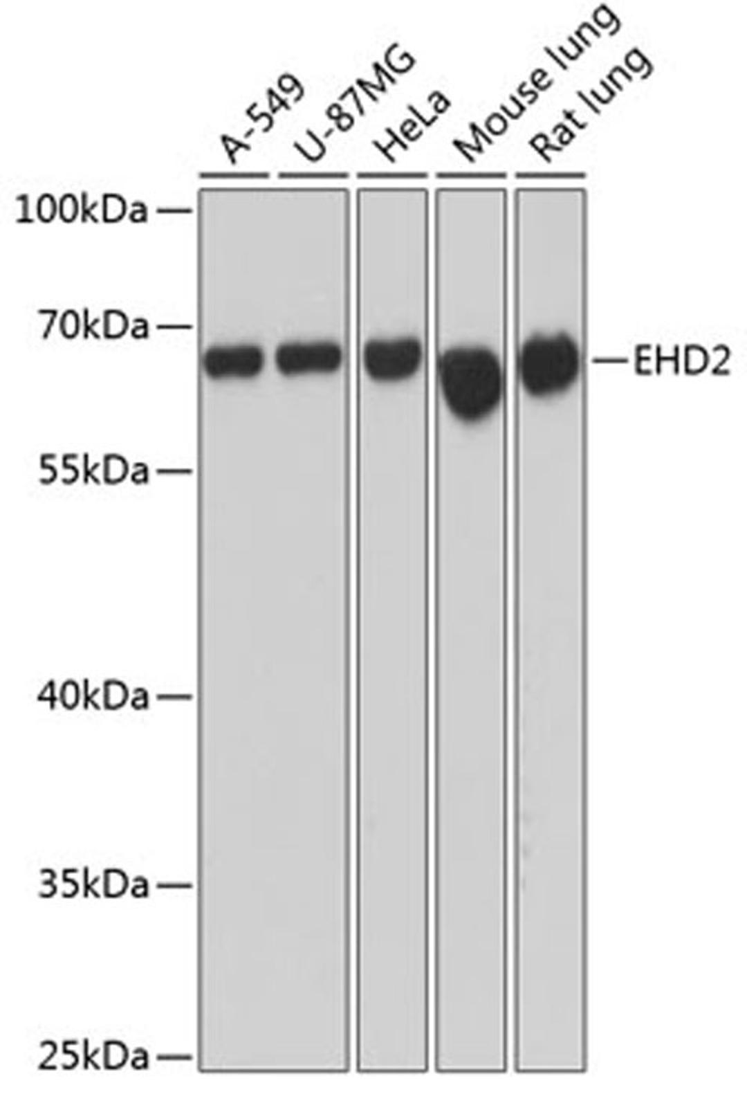 Western blot - EHD2 antibody (A12945)