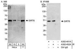 Detection of human Sirt6 by western blot and immunoprecipitation.