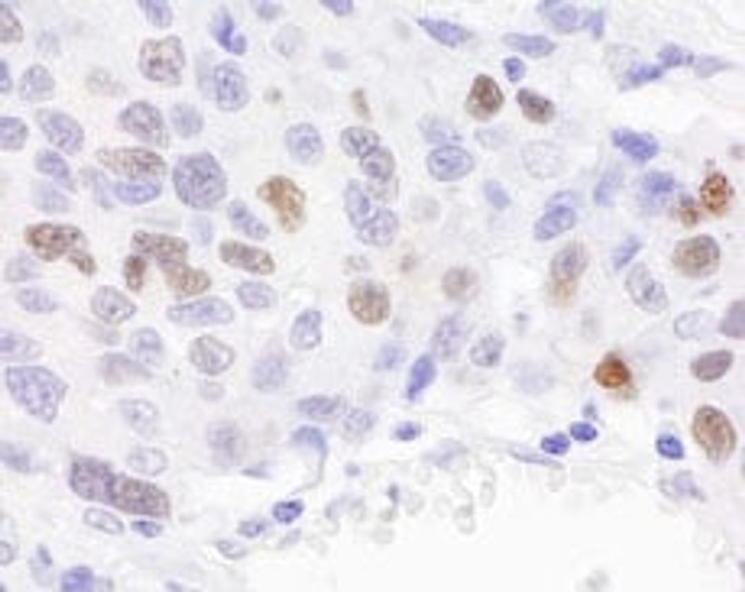 Detection of human RCH1 by immunohistochemistry.