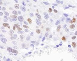 Detection of human RCH1 by immunohistochemistry.