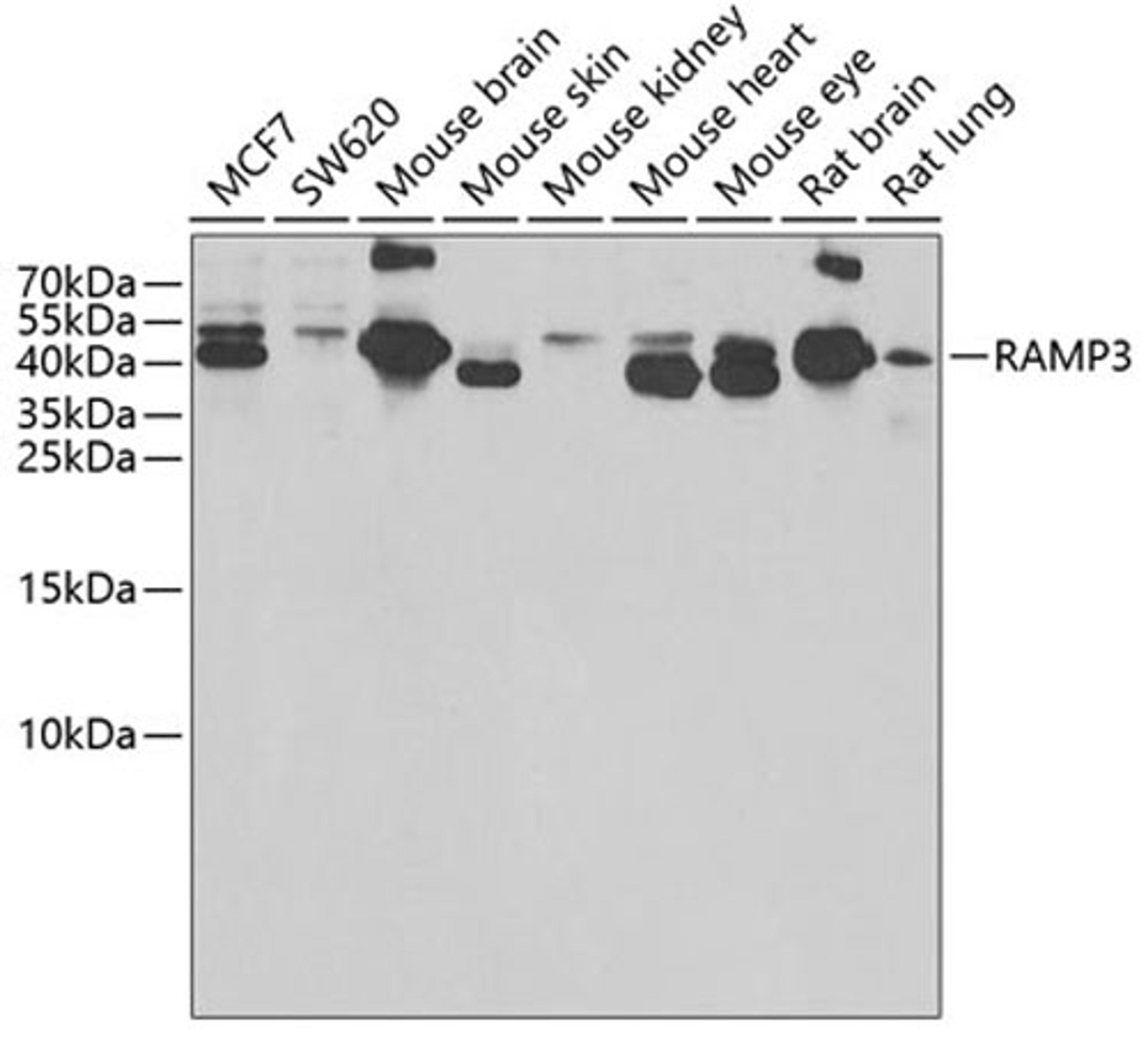 Western blot - RAMP3 antibody (A6715)