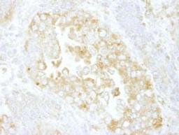 Detection of mouse Cdc42GAP by immunohistochemistry.