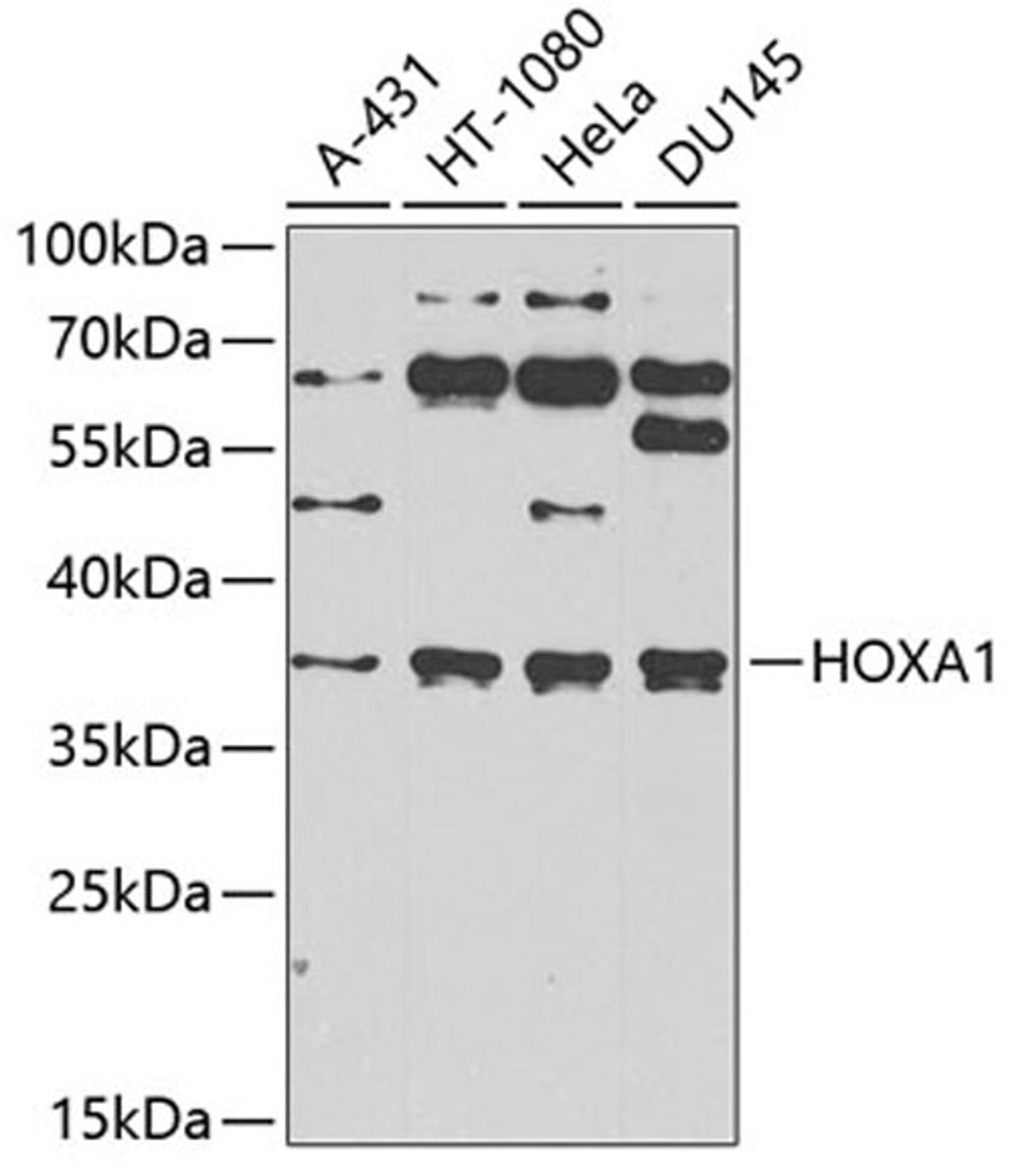 Western blot - HOXA1 antibody (A6924)