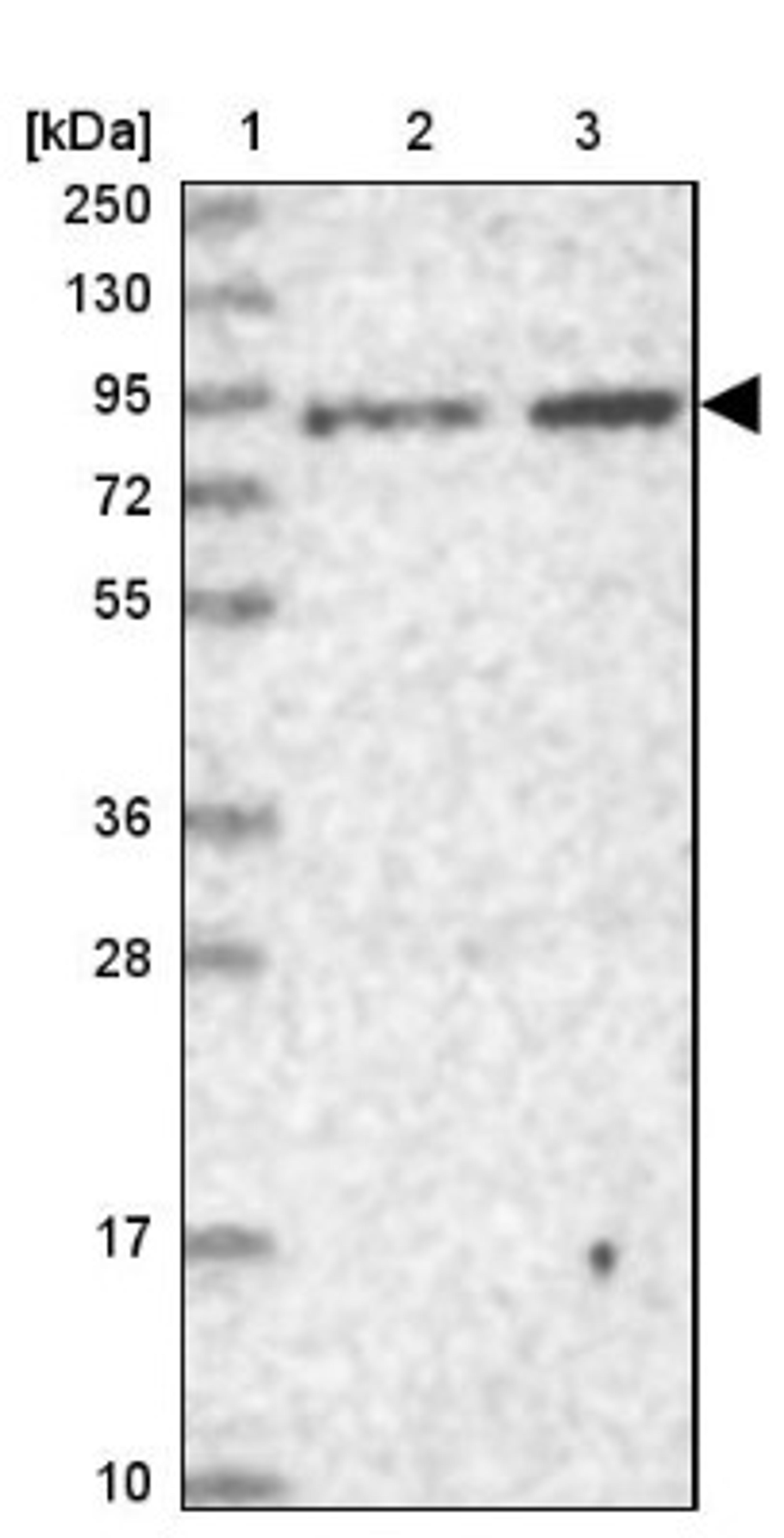 Western Blot: Ring finger protein 214 Antibody [NBP1-87994] - Lane 1: Marker [kDa] 250, 130, 95, 72, 55, 36, 28, 17, 10<br/>Lane 2: Human cell line RT-4<br/>Lane 3: Human cell line U-251MG sp