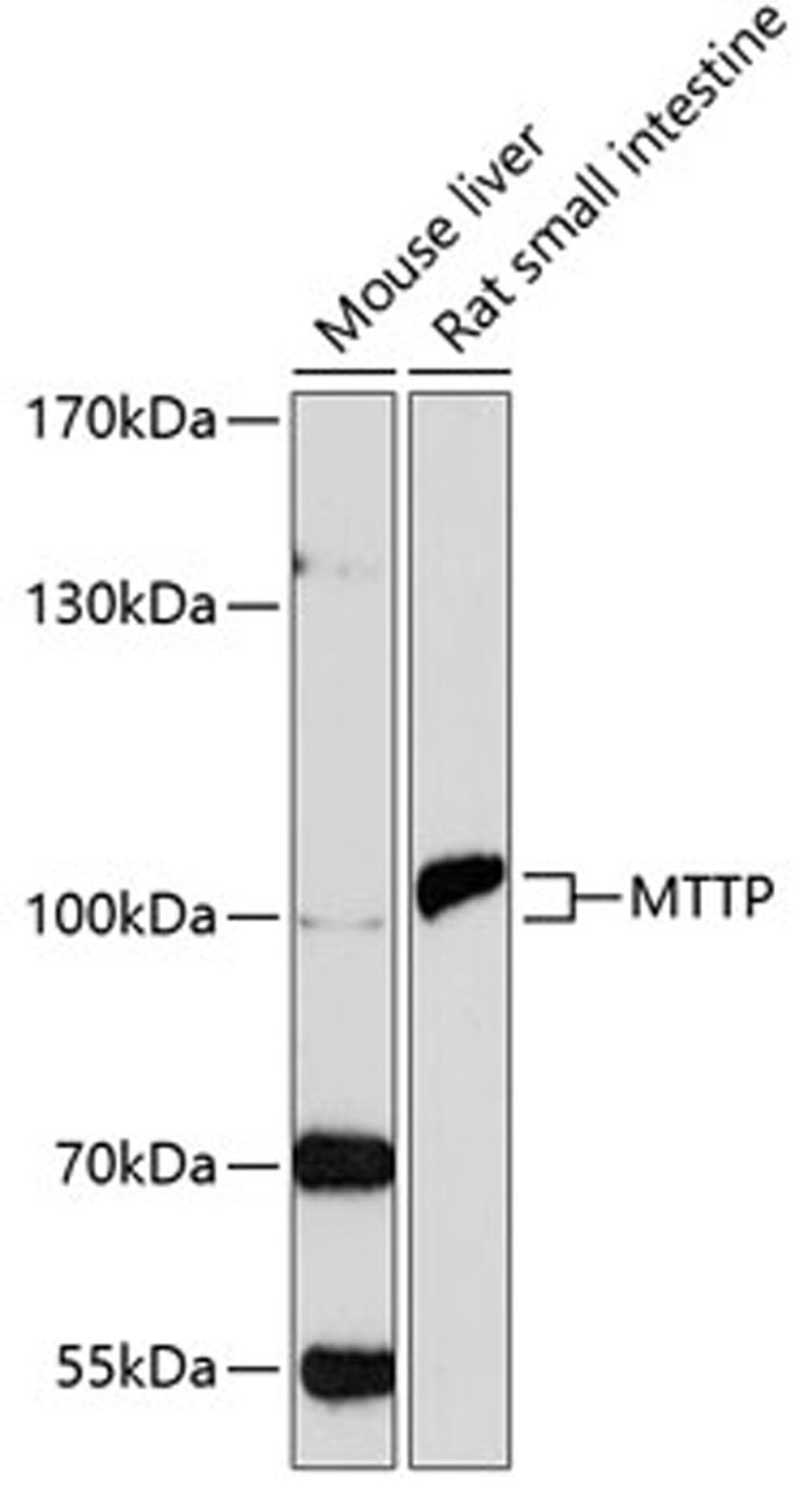 Western blot - MTTP antibody (A1746)