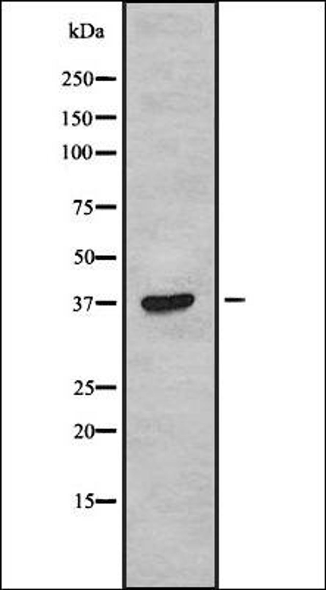 Western blot analysis of COLO205 whole cell lysates using TAS2R38 antibody