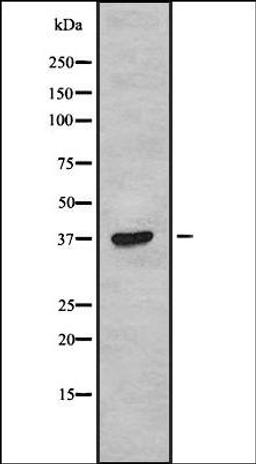 Western blot analysis of COLO205 whole cell lysates using TAS2R38 antibody