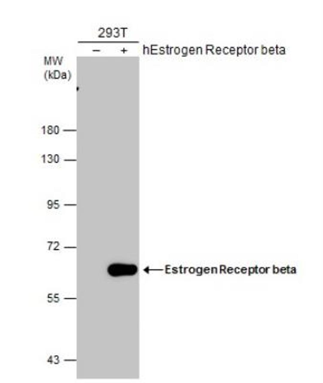 Western Blot: ER beta/NR3A2 Antibody (14C8) [NB200-305] - Non-transfected (-) and transfected (+) 293T whole cell extracts (30 ug) were separated by 7.5% SDS-PAGE, and the membrane was blotted with diluted at 1:5000.