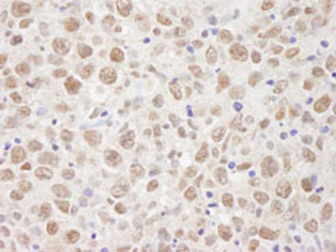 Detection of human BAAT1 by immunohistochemistry.