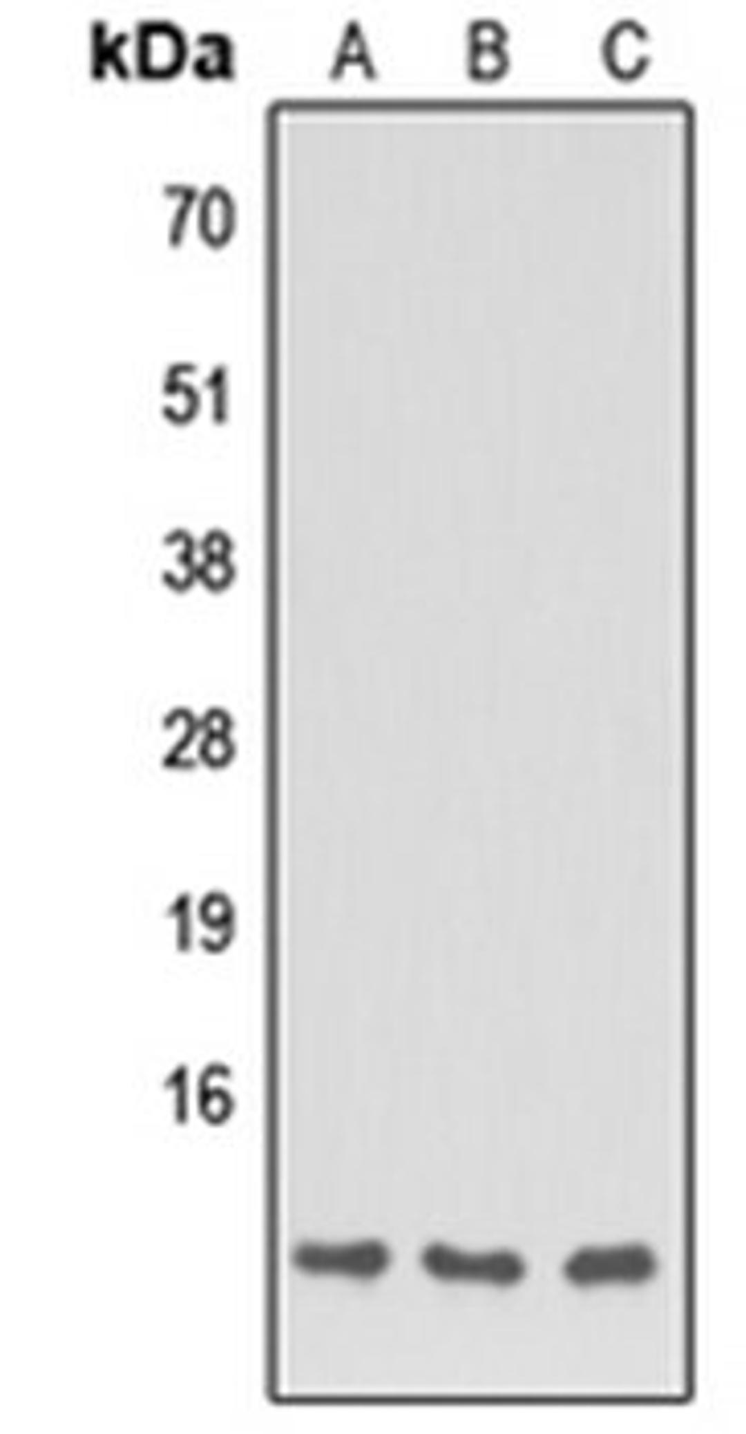 Western blot analysis of HEK293T (Lane 1), NS-1 (Lane 2), H9C2 (Lane 3) whole cell lysates using Apolipoprotein C1 antibody