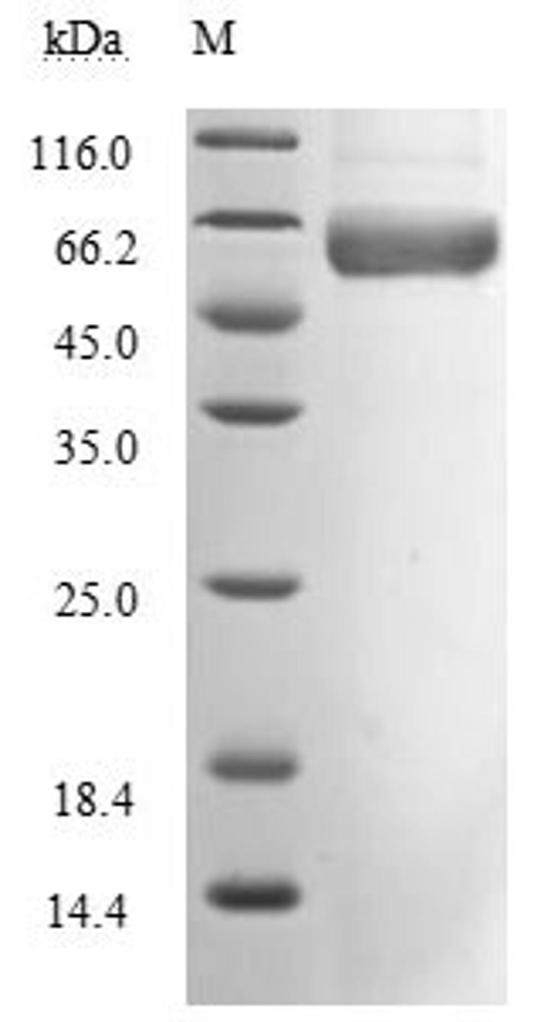 (Tris-Glycine gel) Discontinuous SDS-PAGE (reduced) with 5% enrichment gel and 15% separation gel. Predicted band size: 51.1 kDa Observed band size: 66 kDa due to glycosylation