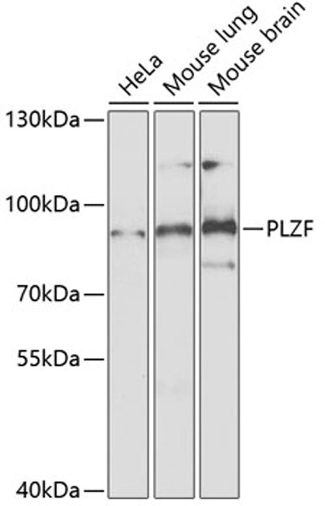 Western blot - PLZF Antibody (A5863)