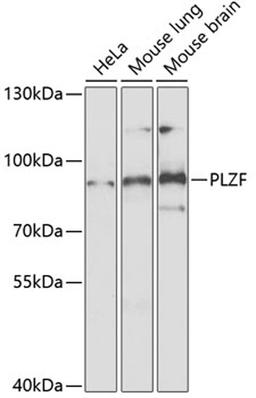 Western blot - PLZF Antibody (A5863)