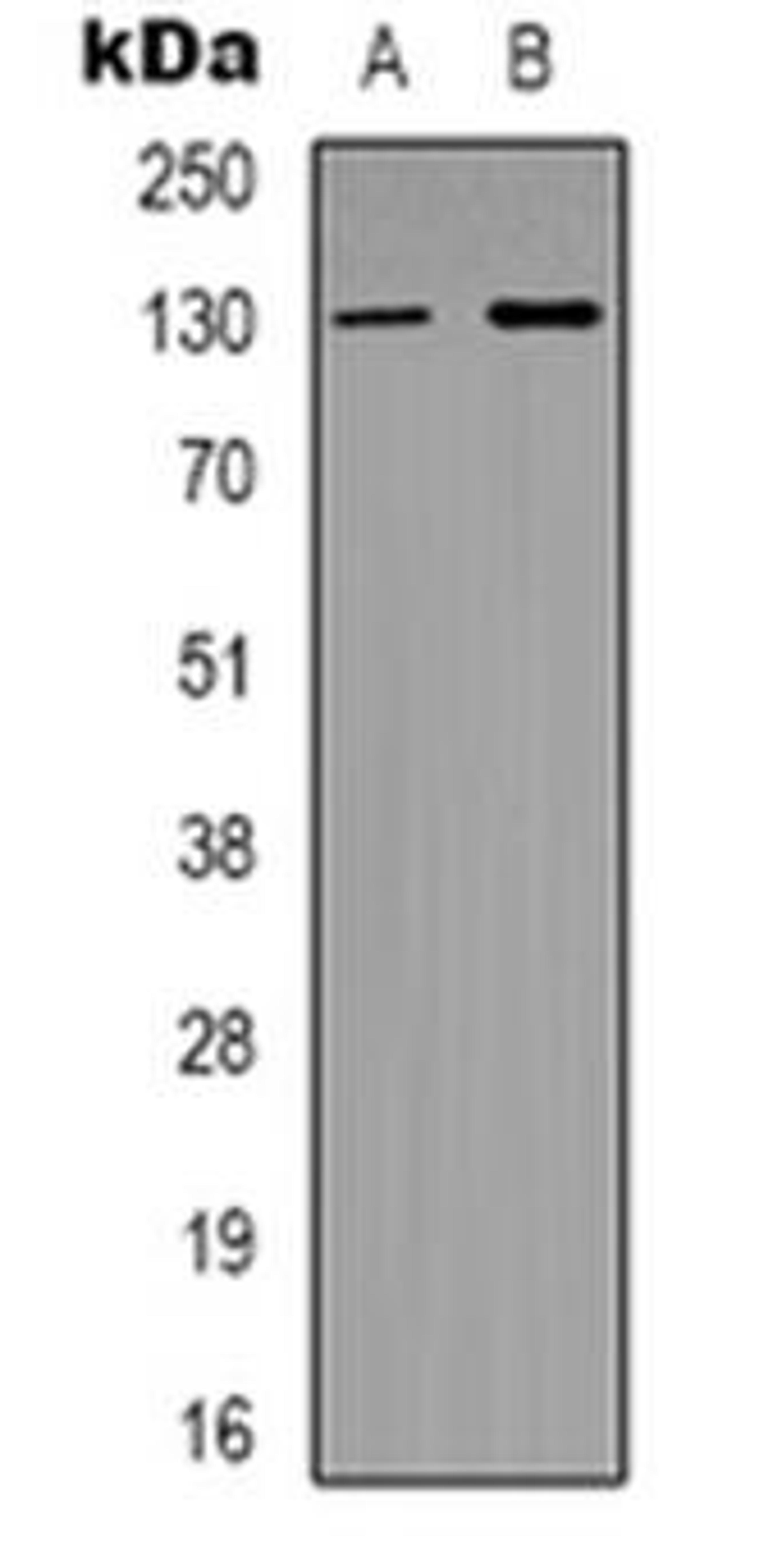 Western blot analysis of SUR2 expression in Hela (Lane 1), MCF7 (Lane 2) whole cell lysates using MED23 antibody