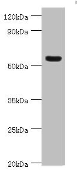 Western blot. All lanes: Vitronectin antibody at 12ug/ml + HepG2 whole cell lysate. Secondary. Goat polyclonal to rabbit IgG at 1/10000 dilution. Predicted band size: 54 kDa. Observed band size: 54 kDa.