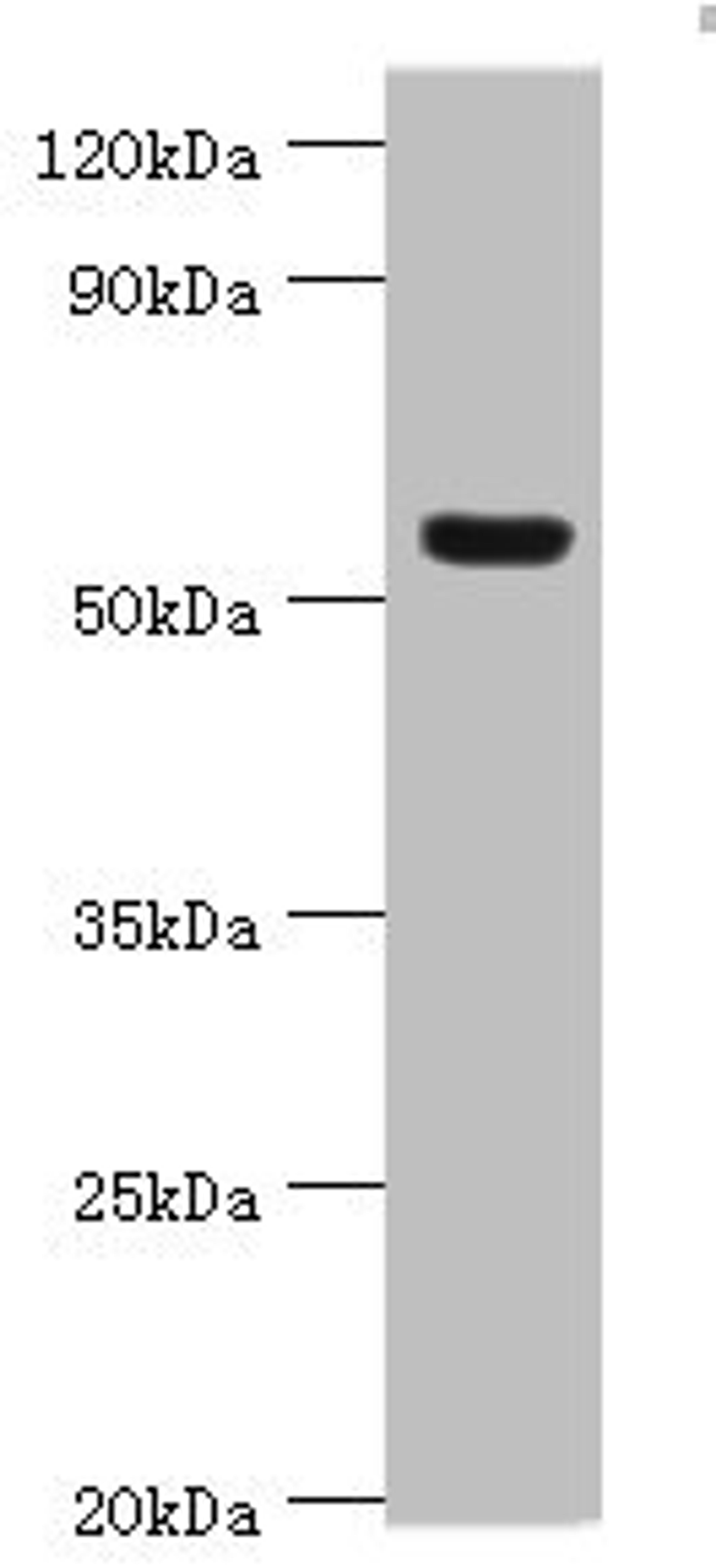 Western blot. All lanes: Vitronectin antibody at 12ug/ml + HepG2 whole cell lysate. Secondary. Goat polyclonal to rabbit IgG at 1/10000 dilution. Predicted band size: 54 kDa. Observed band size: 54 kDa.