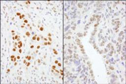 Detection of human and mouse GTF2I/TFII-I by immunohistochemistry.