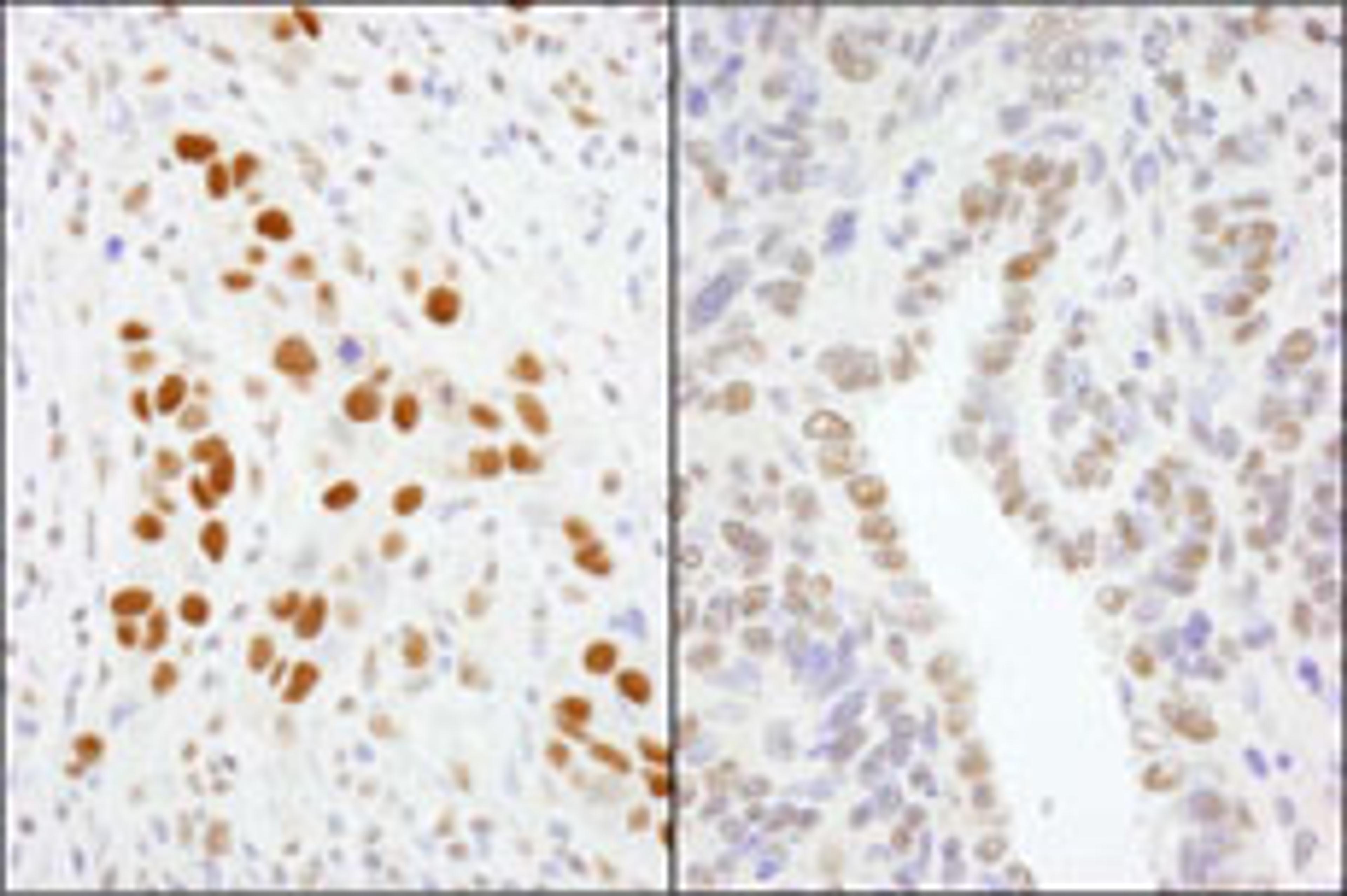 Detection of human and mouse GTF2I/TFII-I by immunohistochemistry.