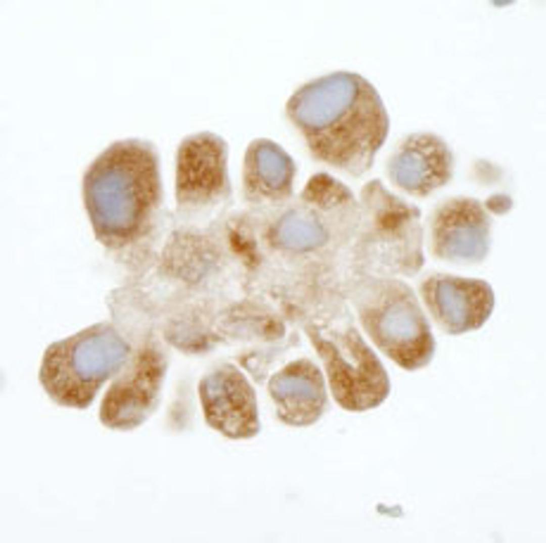 Detection of human DDX3 by immunohistochemistry.