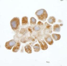 Detection of human DDX3 by immunohistochemistry.