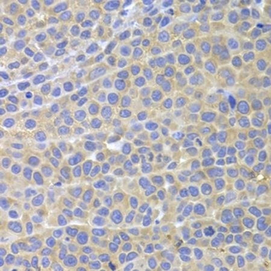 Immunohistochemical staining of mouse cancer tissue using STAT4 antibody