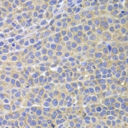 Immunohistochemical staining of mouse cancer tissue using STAT4 antibody