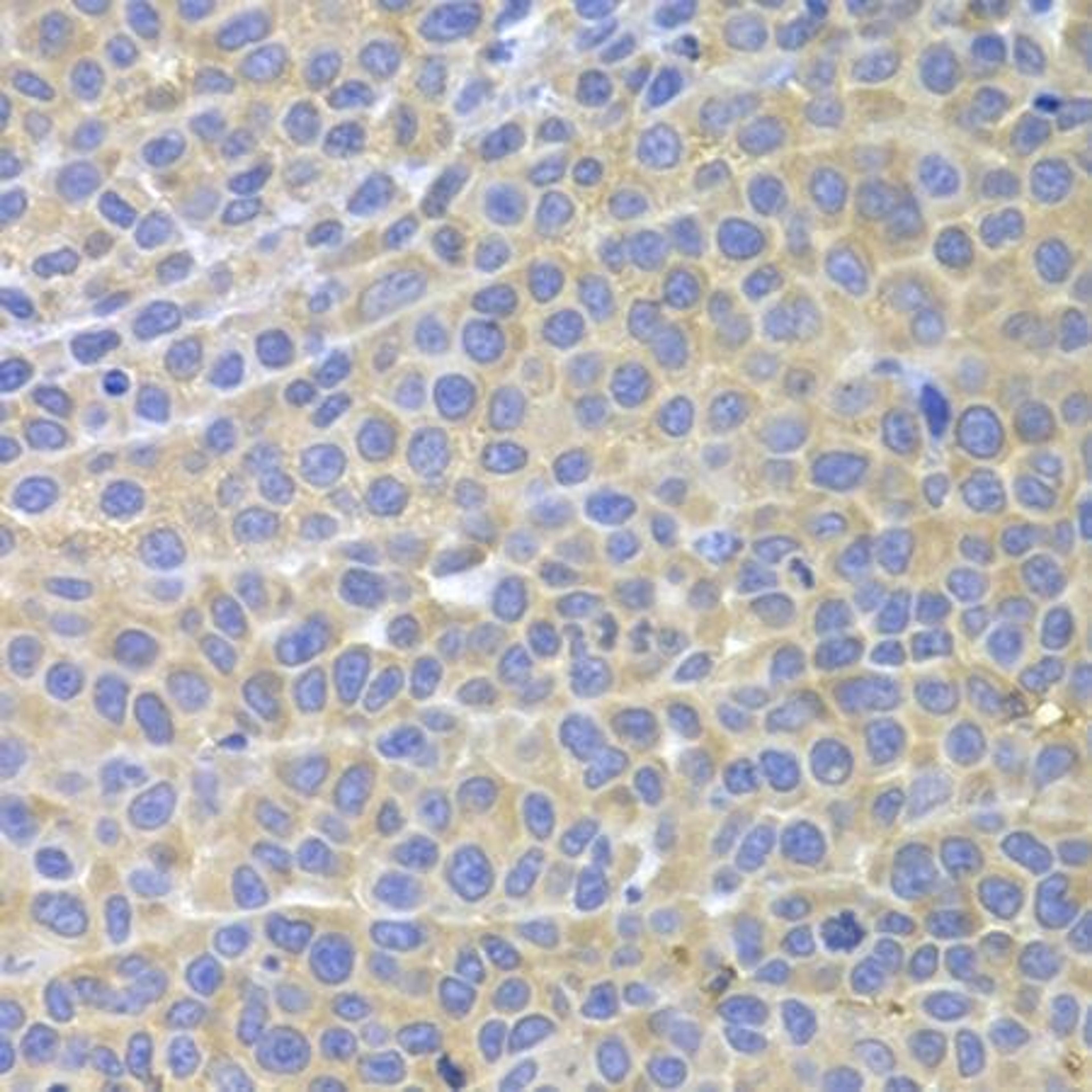 Immunohistochemical staining of mouse cancer tissue using STAT4 antibody