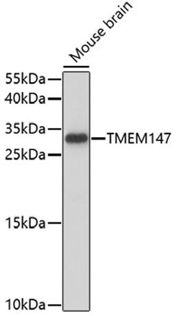 Western blot - TMEM147 antibody (A17076)