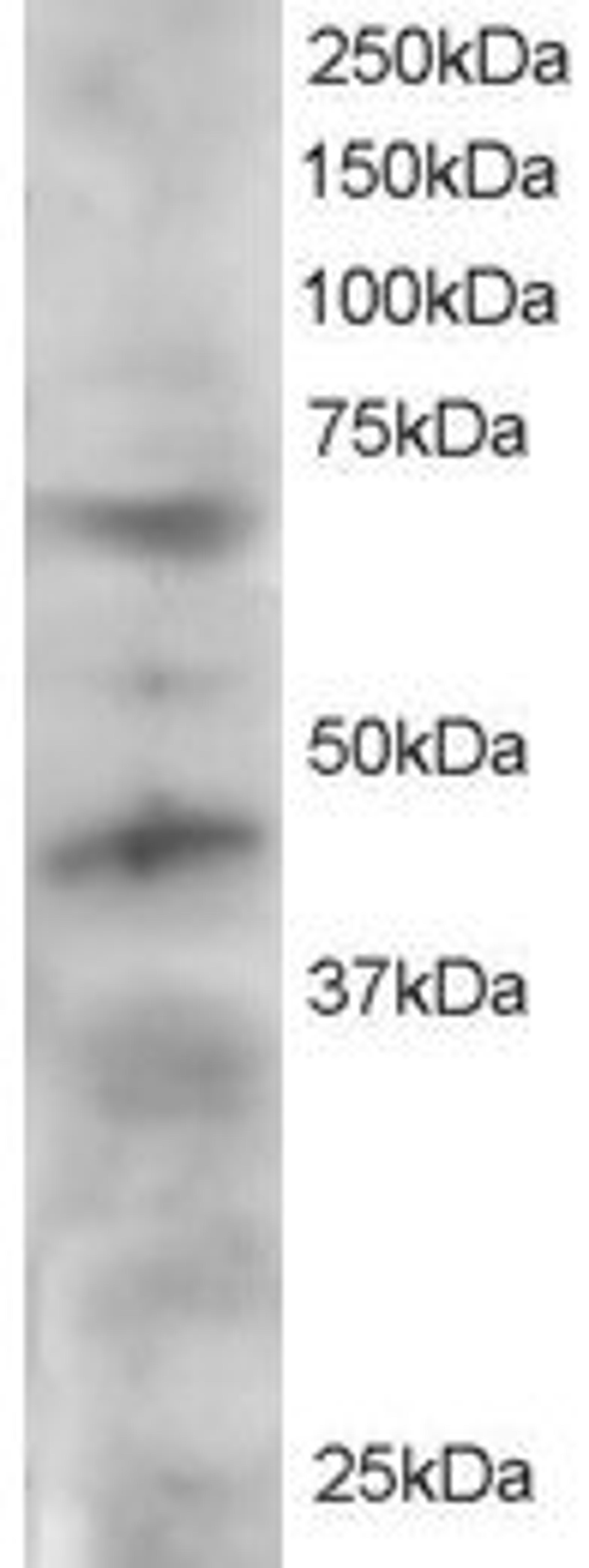 46-480 staining (2ug/ml) of HeLa lysate (RIPA buffer, 30ug total protein per lane). Primary incubated for 12 hour. Detected by western blot using chemiluminescence.